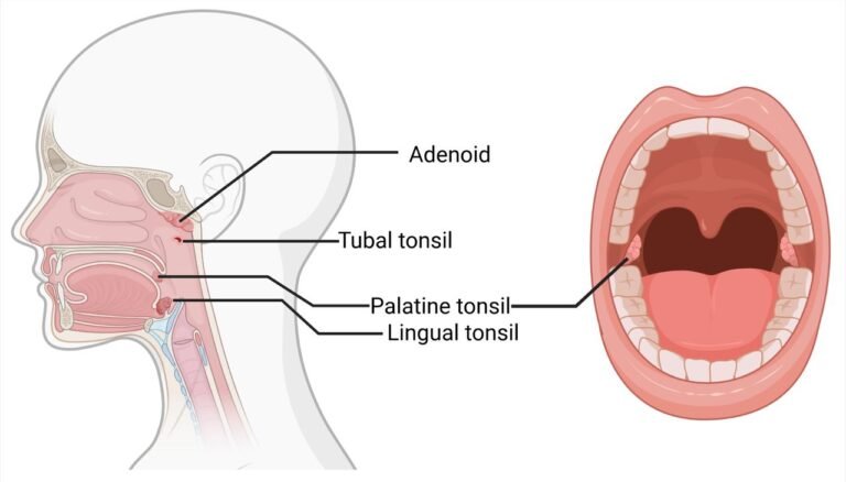 Adenoidid in Children: Causes, Risks, and Diagnosis