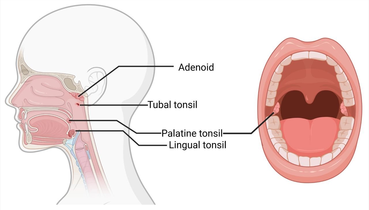 Adenoidid in Children: Causes, Risks, and Diagnosis